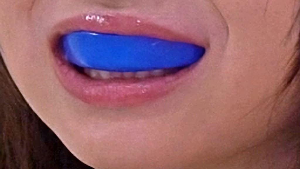 A single-layer sports mouthguard